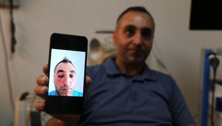 Bitlis’te kapalı yöntemle gözyaşı kanalı ameliyatı