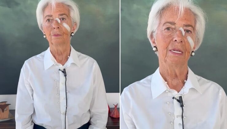 İstifa videosunda herkes yüzüne odaklandı! Gerçeği kendisi açıkladı
